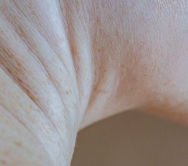When should I Worry about a Lump under my Chin?