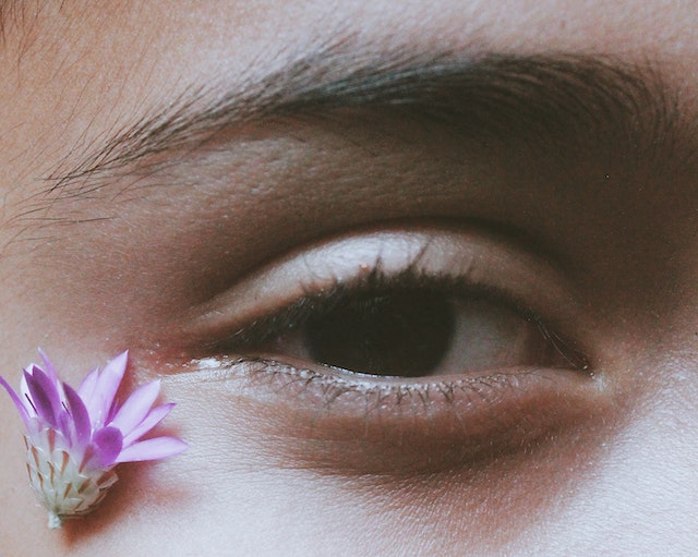 What is commonly misdiagnosed as pink eye?