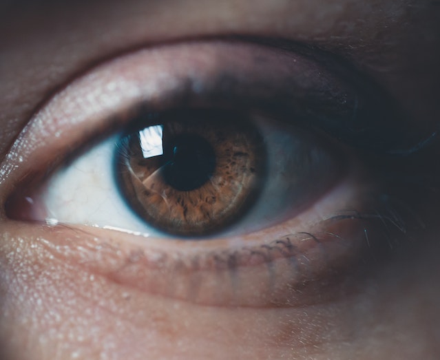 Why do africans have yellow eyes?