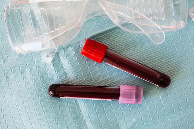 What color is healthy blood