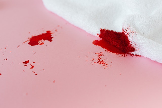 Why am i only bleeding when i wipe after peeing?