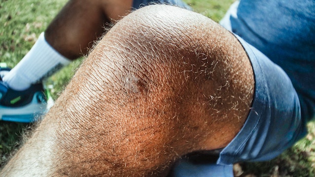 How I Cured my Osteoarthritis Naturally?
