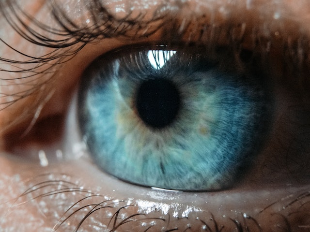What causes black people's eyes to turn blue?