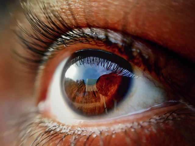 Why did my brown eyes turn green?