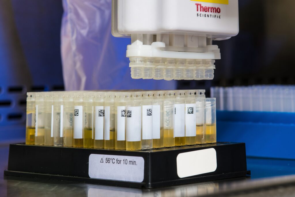 Why has my urine got a sweet smell?