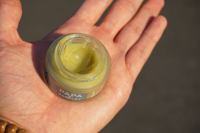 Can you put Aquaphor on a second degree burn?