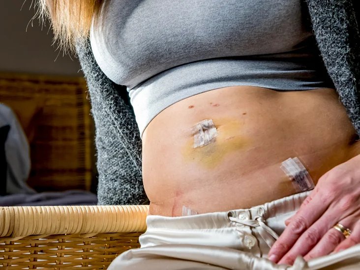 Can a man feel a difference after a hysterectomy?