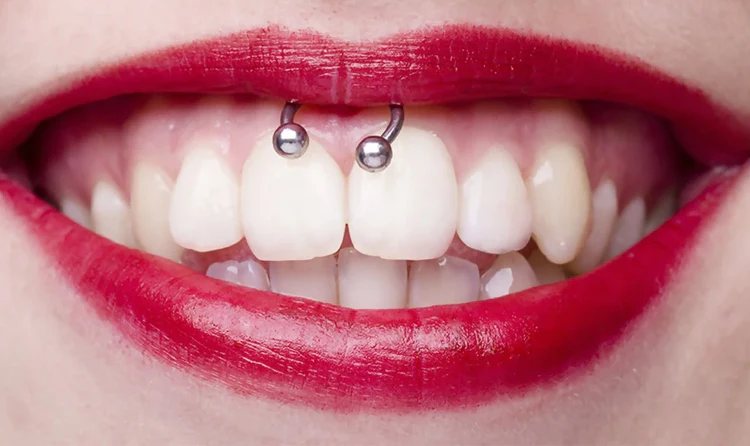 How long will a smiley piercing last?