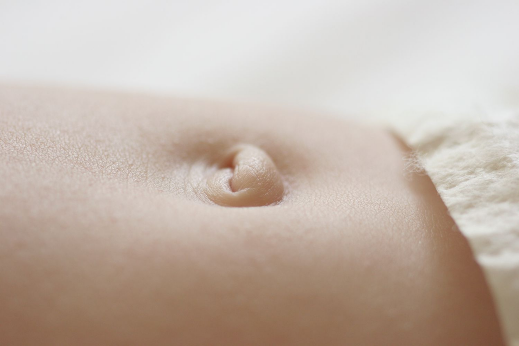 What makes an innie vs outie belly button?