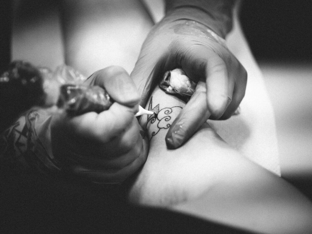 What stage does a Tattoo Itch?