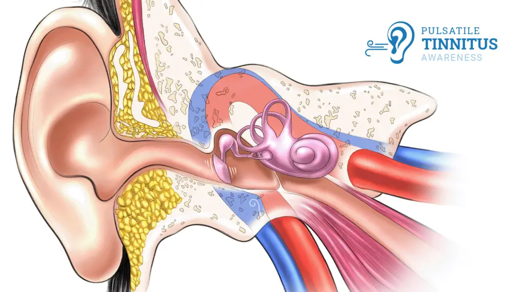 which-antihistamine-is-best-for-tinnitus-gek-buzz