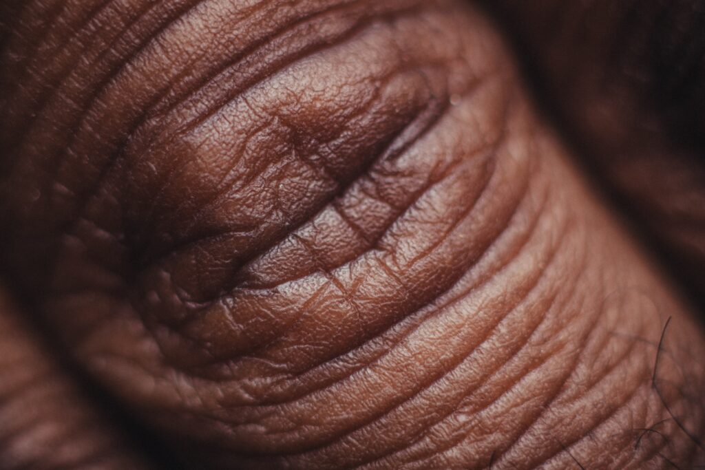 Why Do Balls Have Wrinkles?