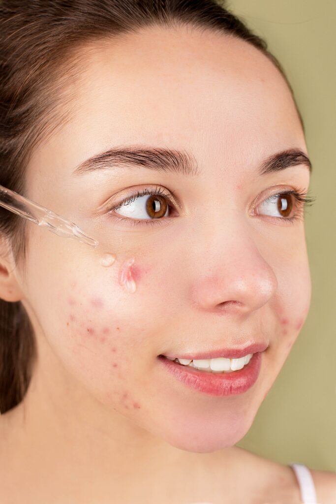 What do clogged pores look like
