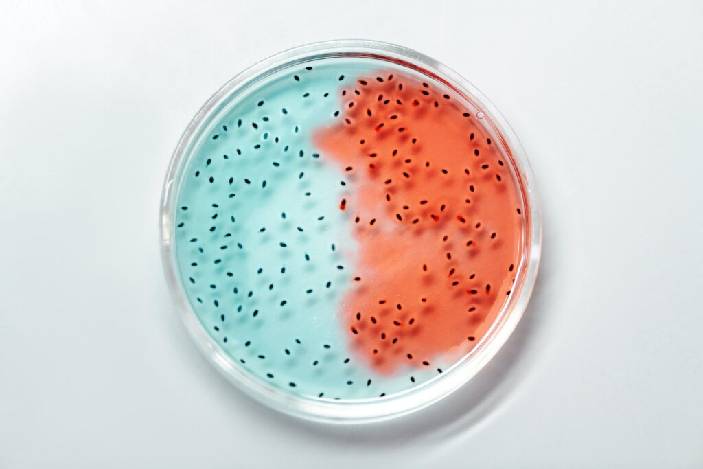 What temperature kills salmonella instantly?