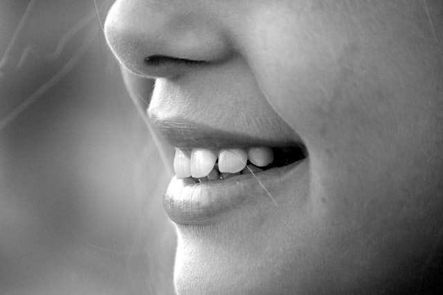 What has miley cyrus done to her teeth