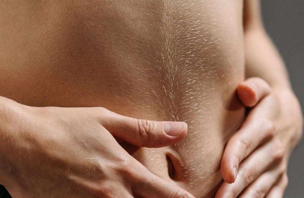 Why is my stomach so hairy female?