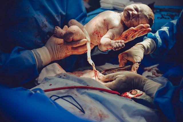 What happens if you accidentally pull off umbilical cord?