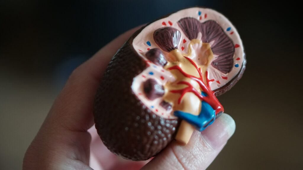 How can i pass a kidney stone in 24 hours naturally?