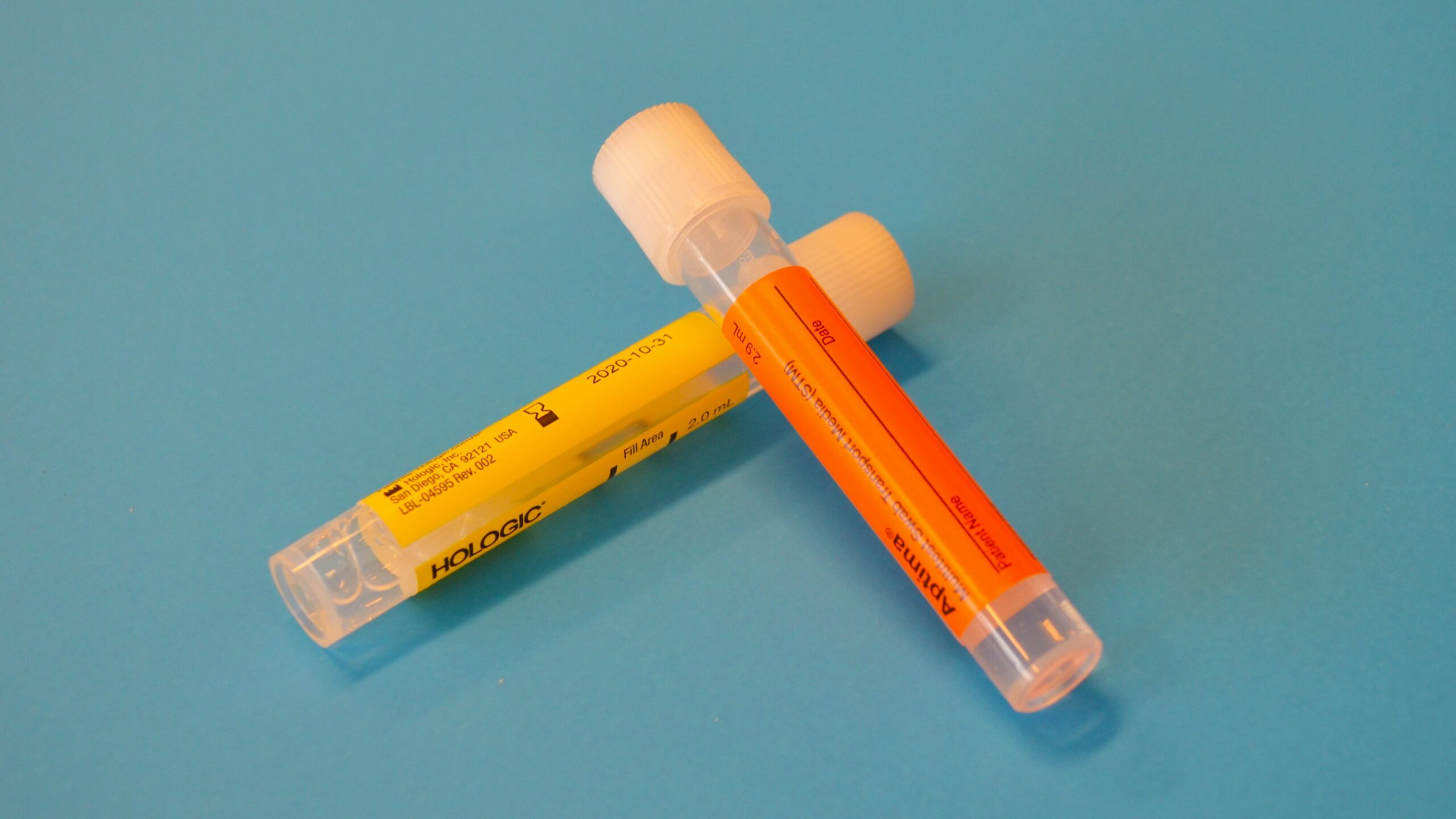 Why is my urine sticky? Gek Buzz