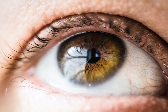 Do Natural Black Eyes Exist?